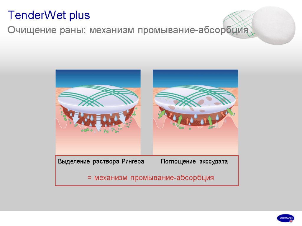 TenderWet plus Очищение раны: механизм промывание-абсорбция Выделение раствора Рингера Поглощение экссудата = механизм промывание-абсорбция